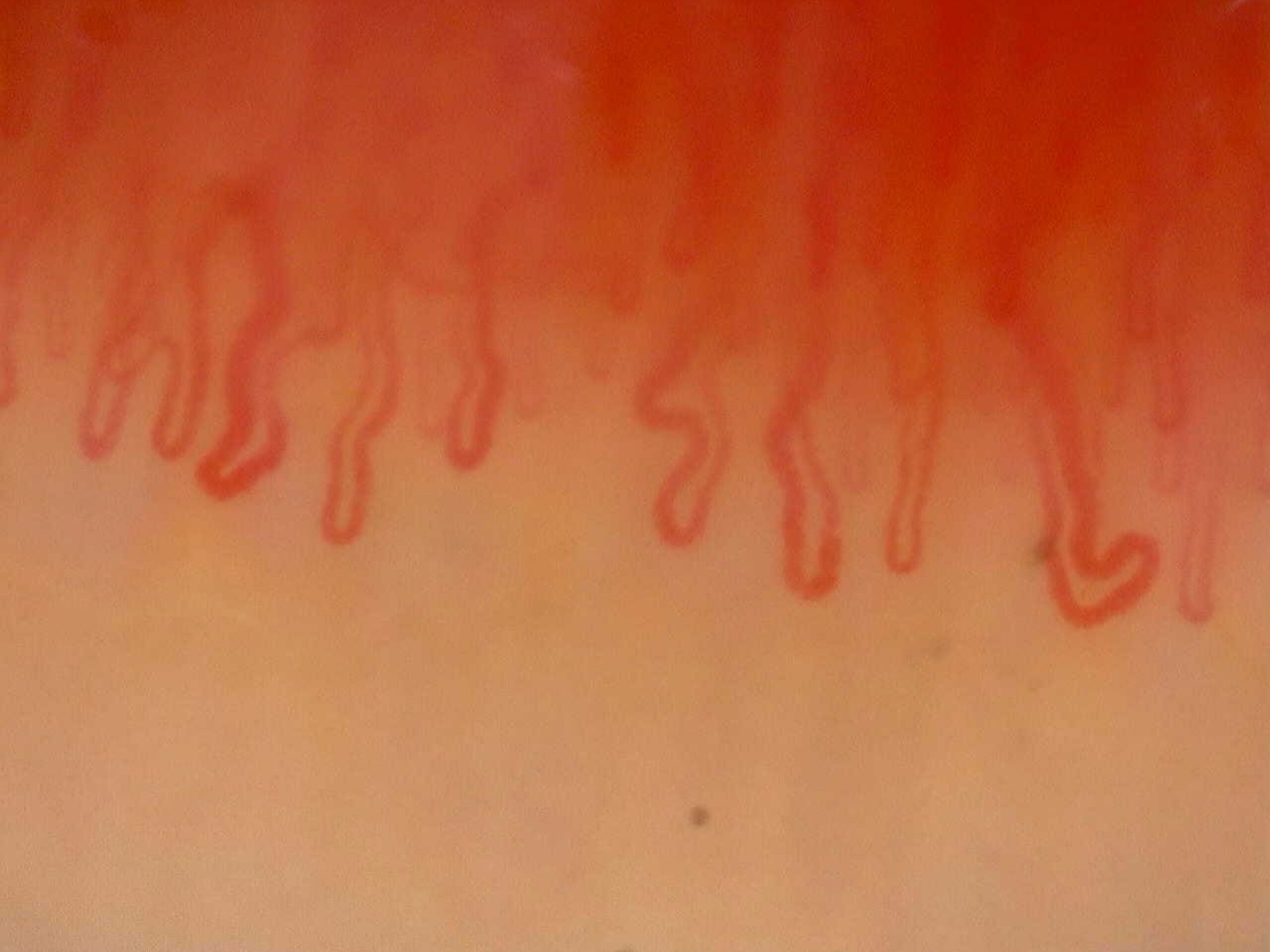 Análisis microvascular